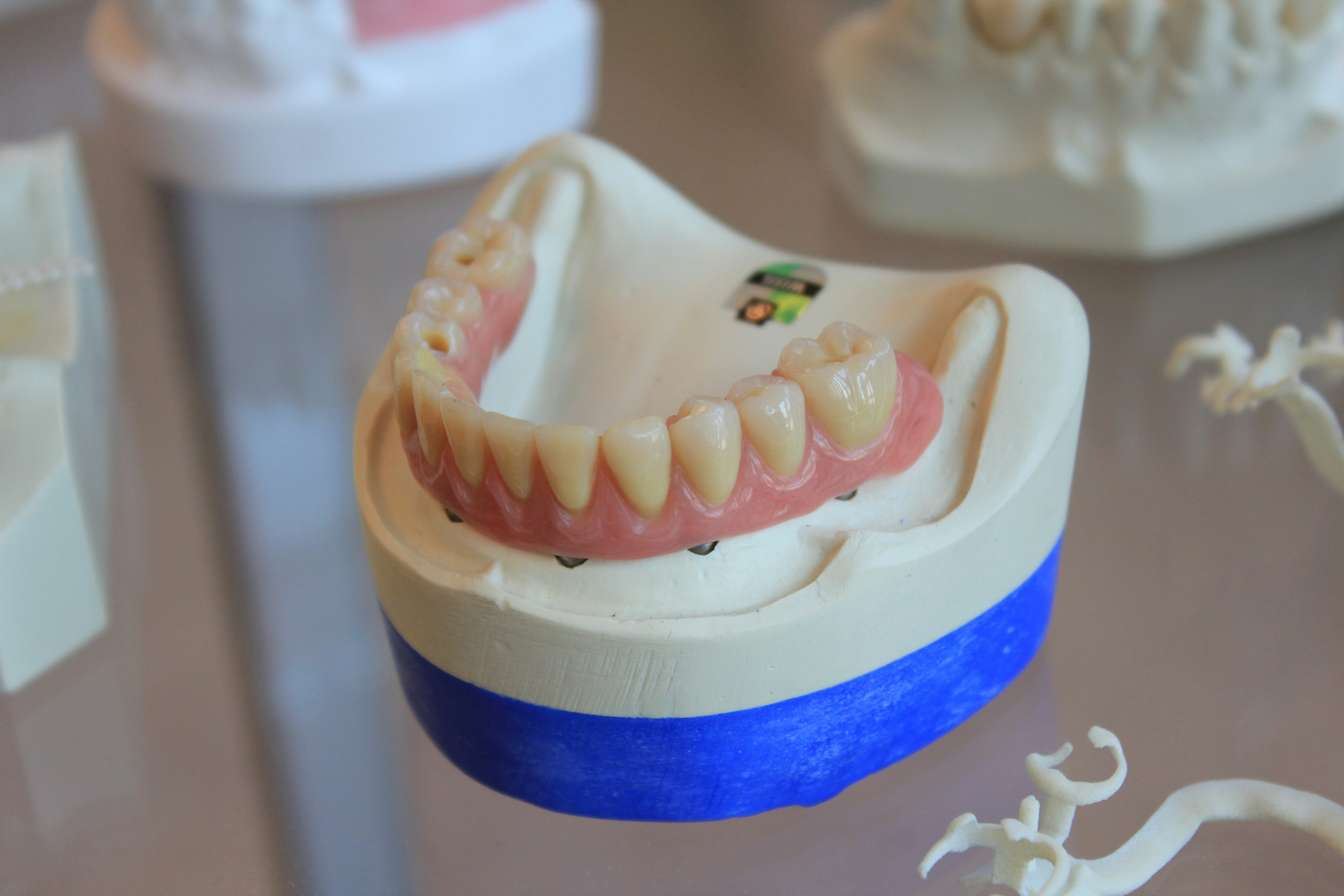 Dentes Fixos no Dia