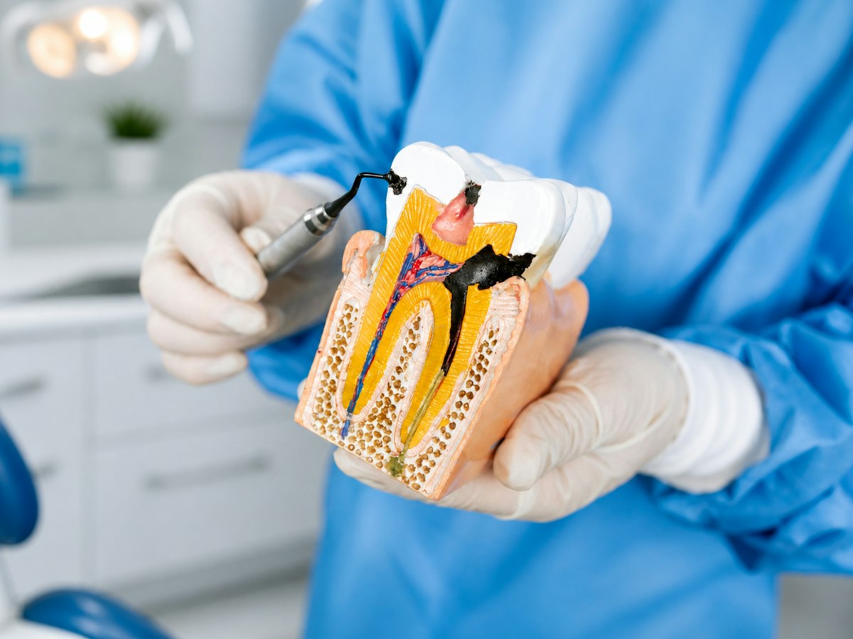 Endodontia